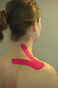 Medical taping